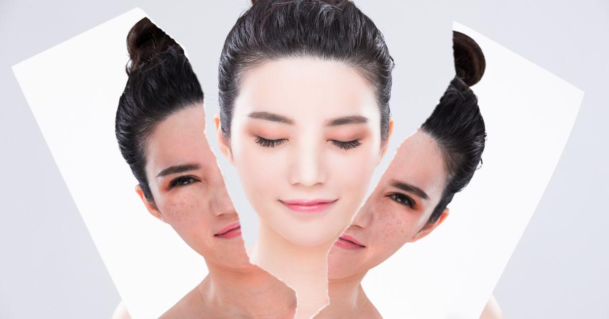 陳裕豪醫師雞尾酒技術皮秒除斑|皮醫美南勢角診所