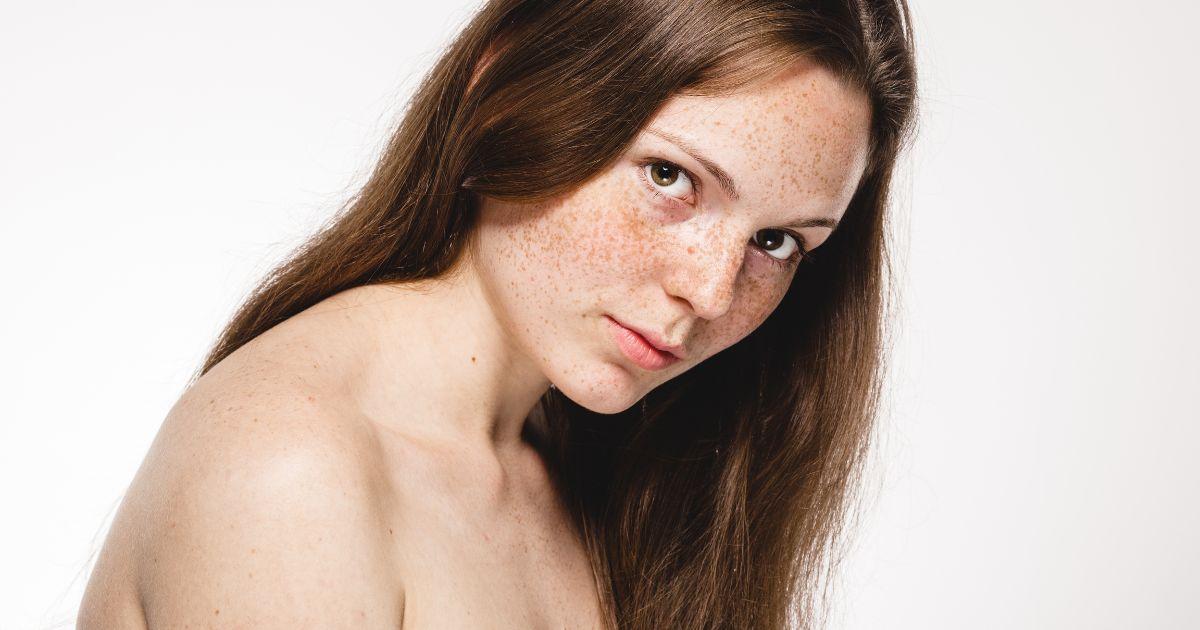 陳裕豪醫師雞尾酒技術皮秒除斑|皮醫美南勢角診所