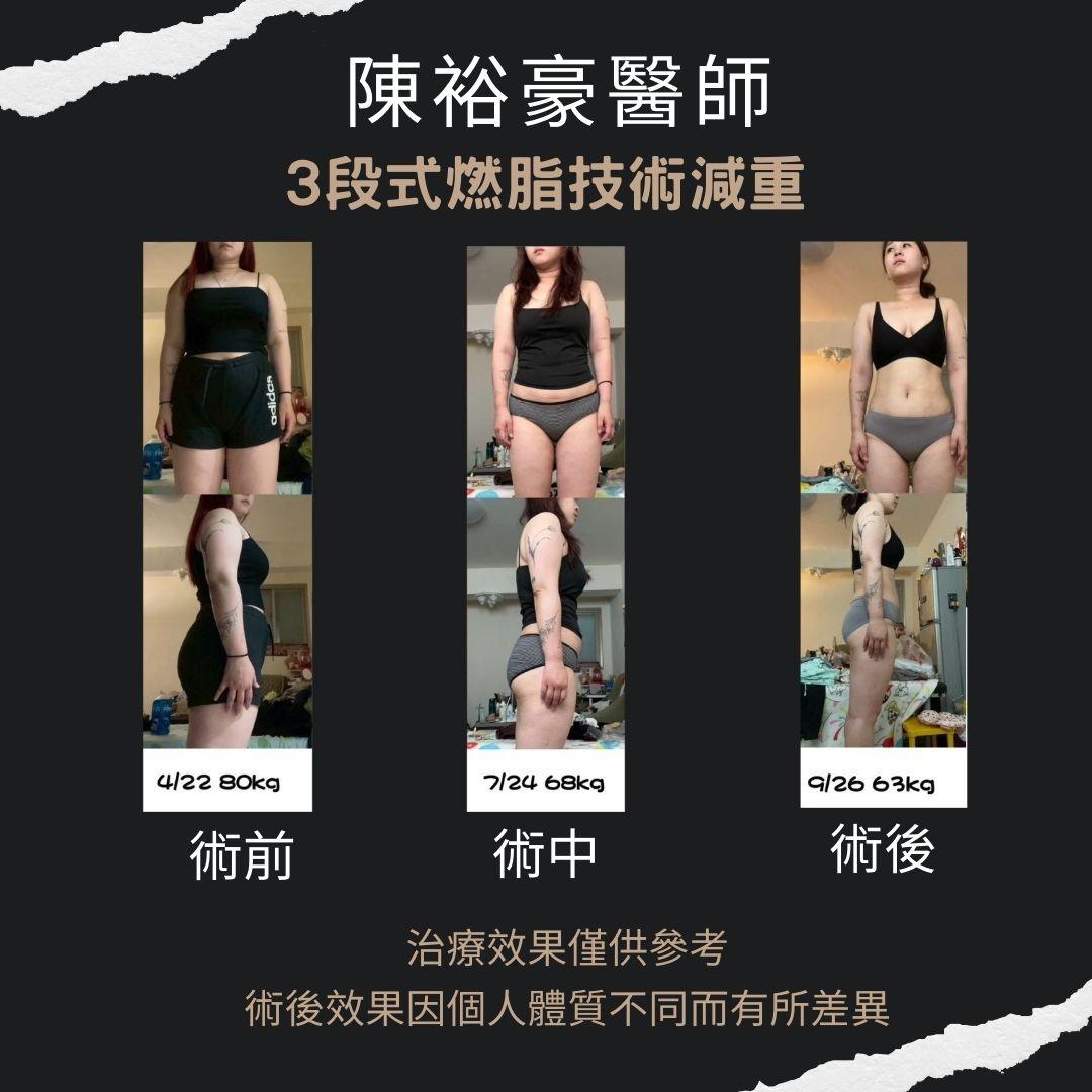 高階抗老 陳裕豪醫師 3段式燃脂技術減重